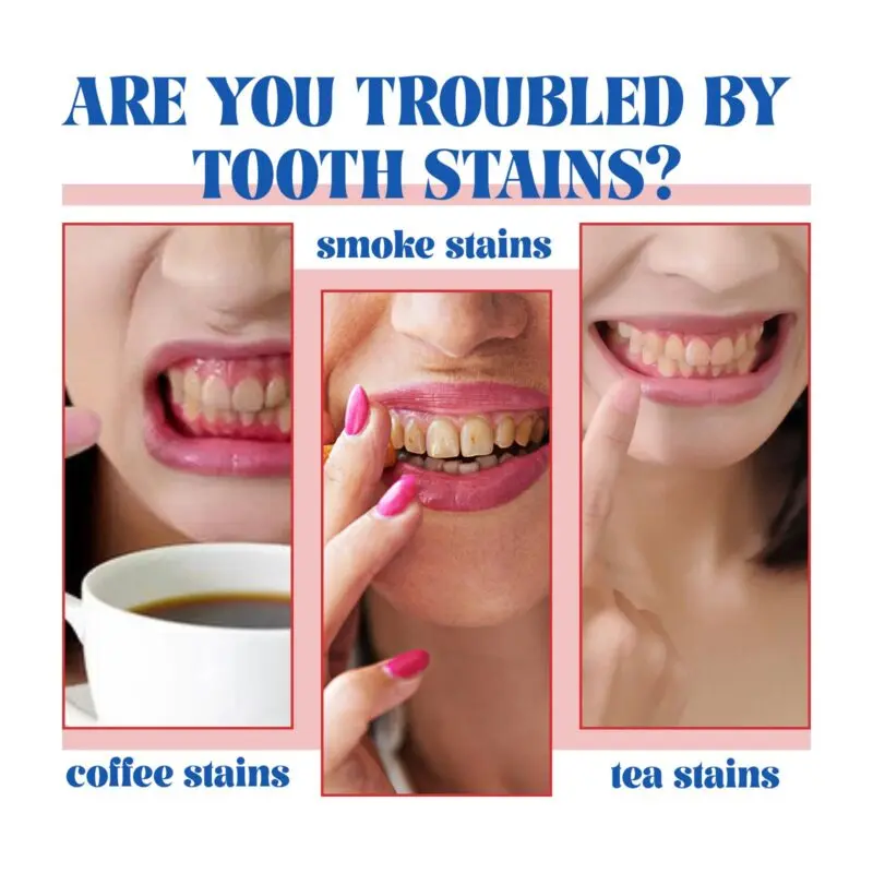 Oralhoe Probiotic Toothpaste - Teeth Whitening, Stain Removal, Gum Care - Image 4