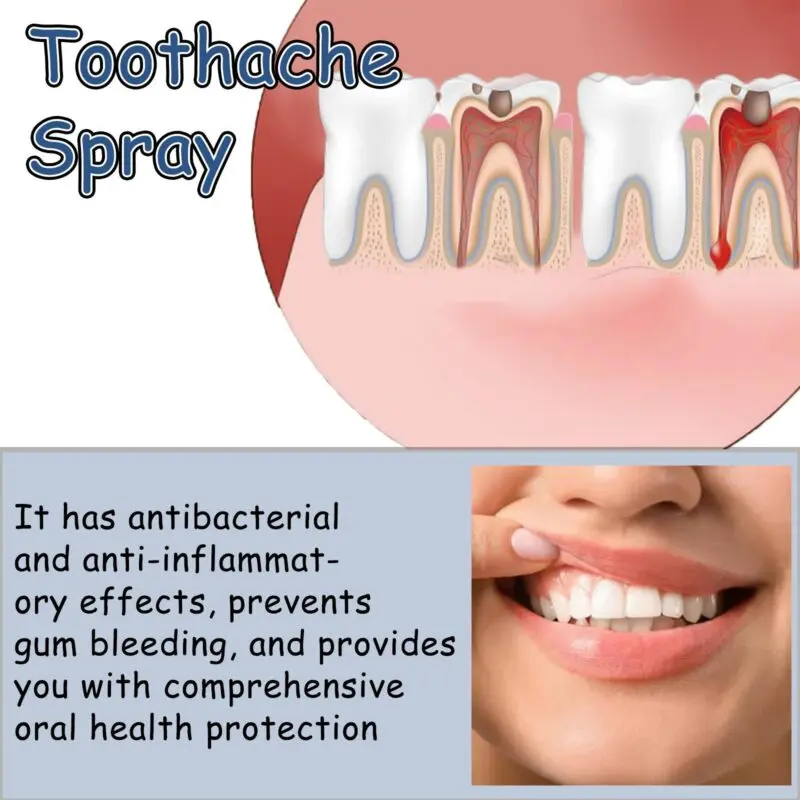 Oralhoe Toothache Relief Spray for Gum Swelling & Oral Discomfort - Image 3