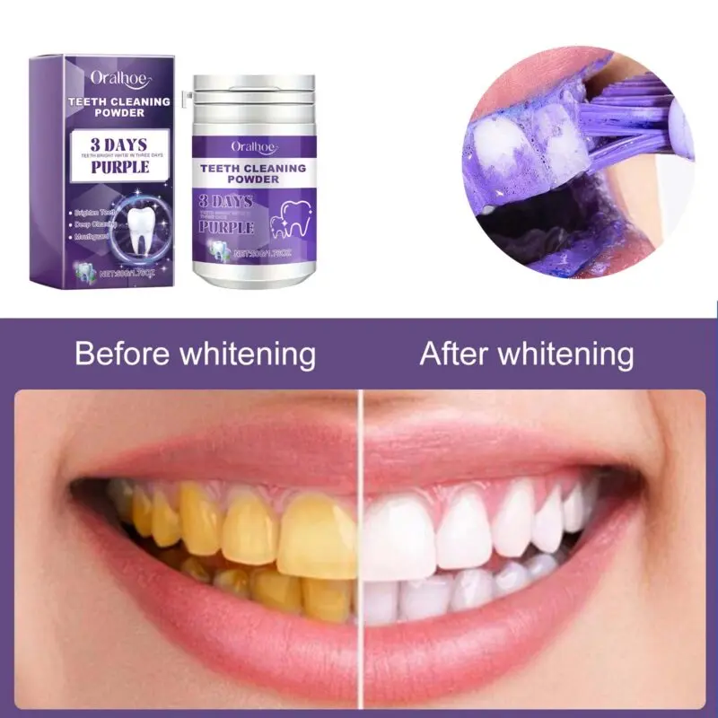 Oralhoe Teeth Cleaning Powder: Tartar & Stain Removal, Teeth Whitening - Image 4
