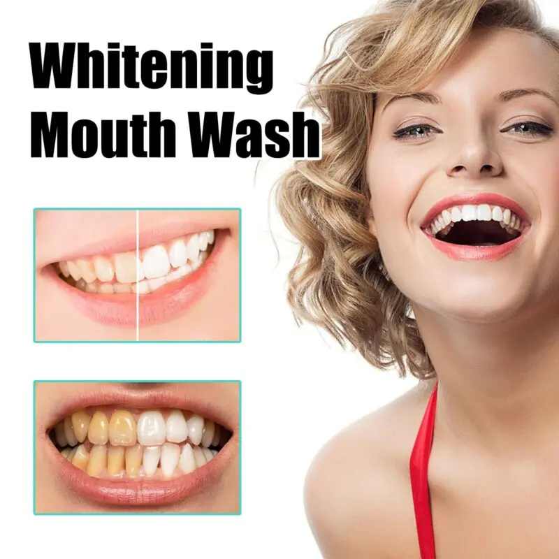 Oralhoe Coconut Mint Whitening Mouthwash for Fresh Breath, Gum Care & Oral Hygiene - Image 3