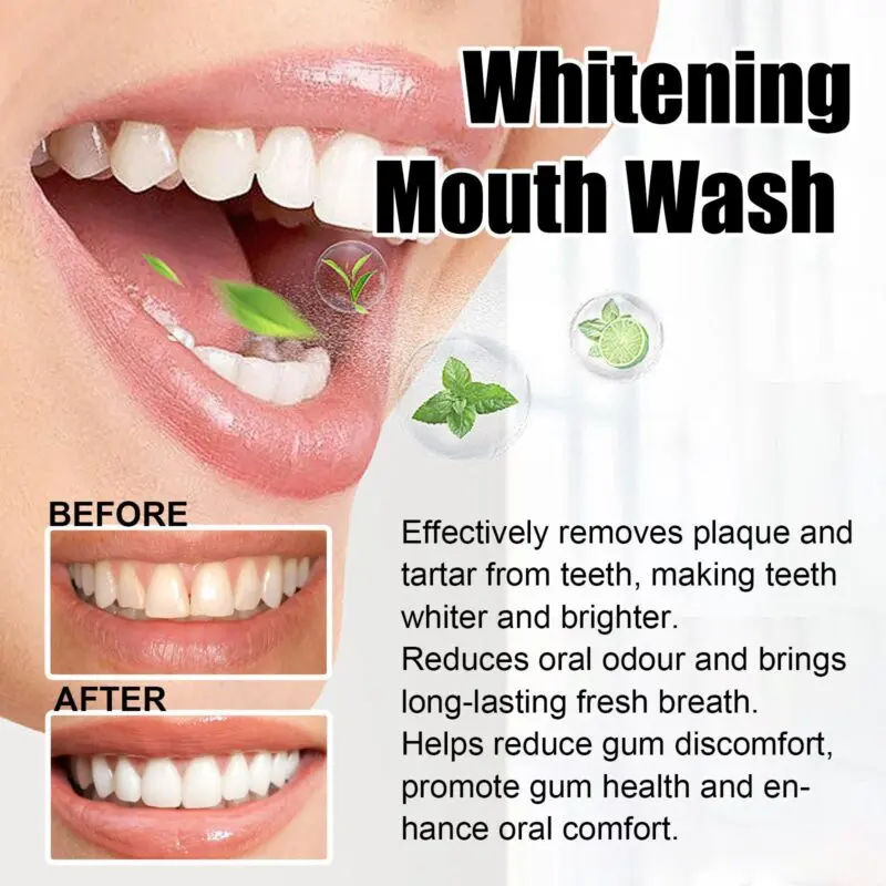 Oralhoe Coconut Mint Whitening Mouthwash for Fresh Breath, Gum Care & Oral Hygiene - Image 4