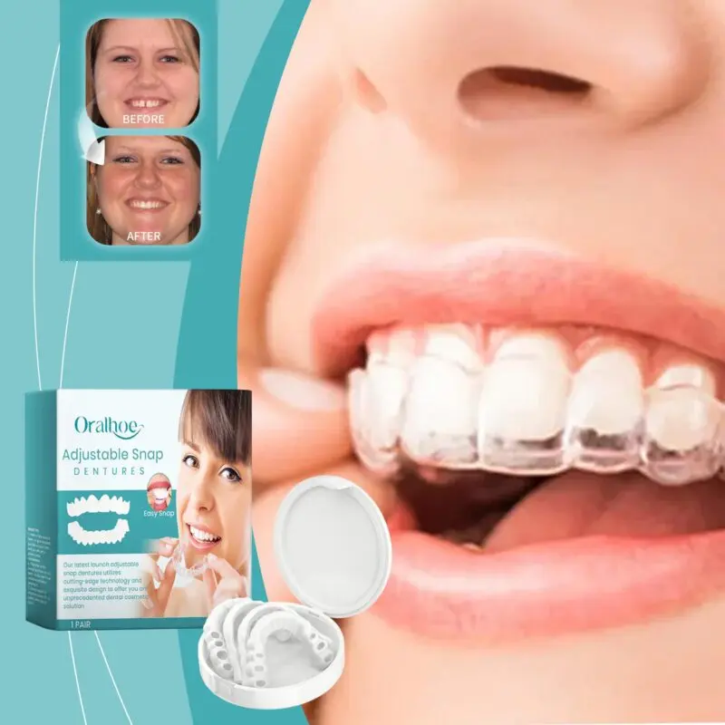 Oralhoe Adjustable Buckle Dentures - Comfortable Fit & Chewing Support - Image 2