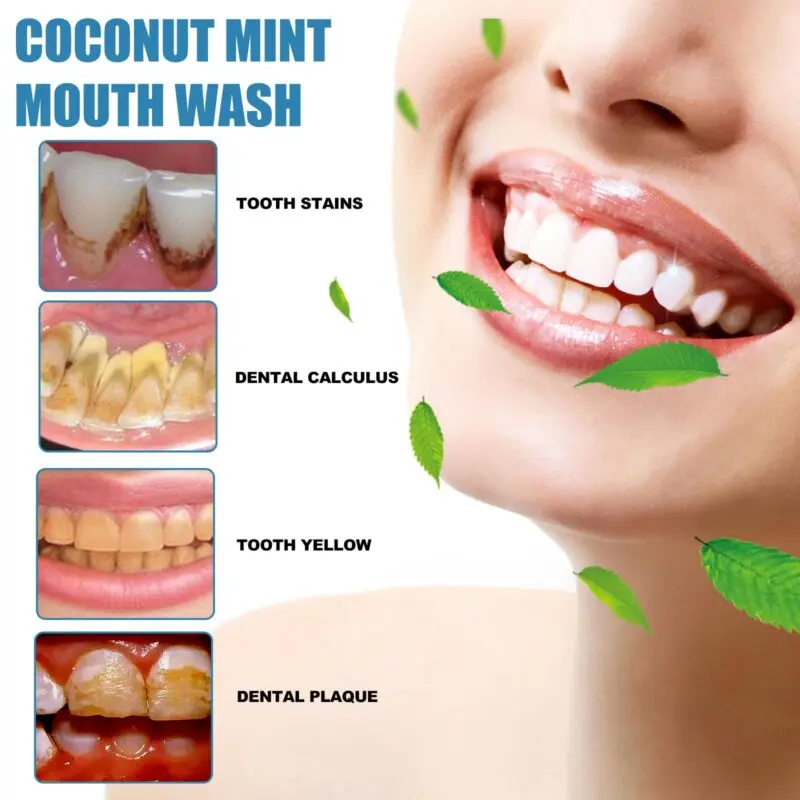 Oralhoe Coconut Mint Mouthwash for Fresh Breath and Oral Care - Image 3