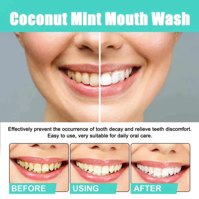 Oralhoe Coconut Mint Mouthwash for Fresh Breath and Oral Care - Image 4