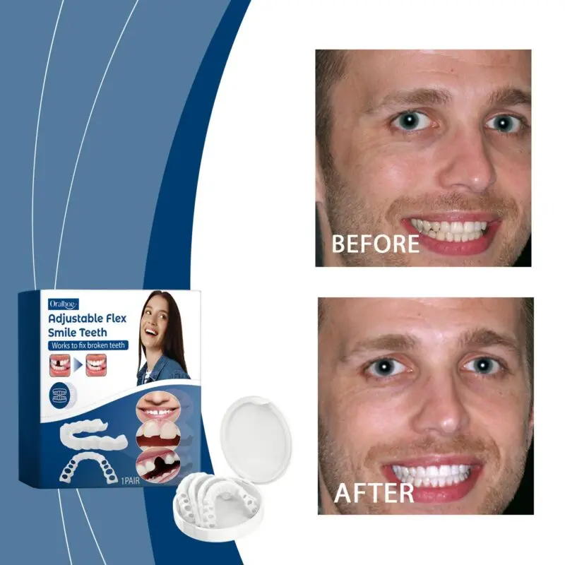 Oralhoe Adjustable Buckle Dentures - Silicone Denture Set - Image 2