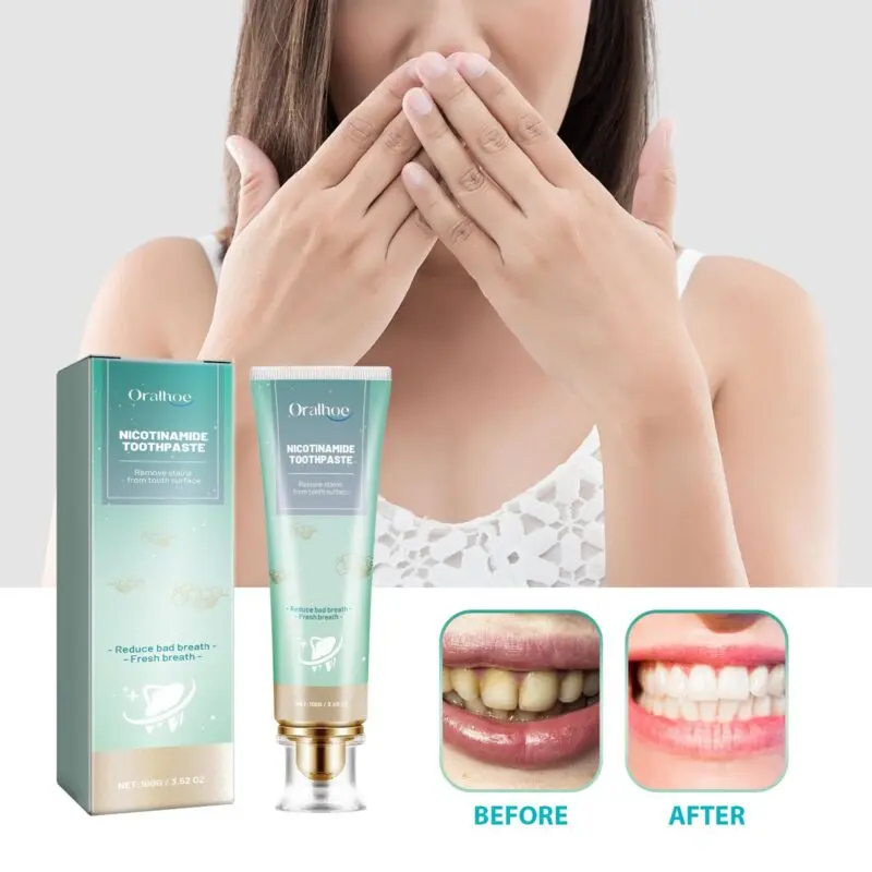Oralhoe Nicotinamide Toothpaste: Whitening, Stain Removal & Fresh Breath - Image 2