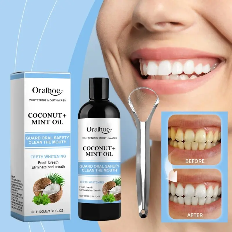 Oralhoe Coconut Mint Oil Mouthwash - Fresh Breath, Gum Care & Stain Removal - Image 2