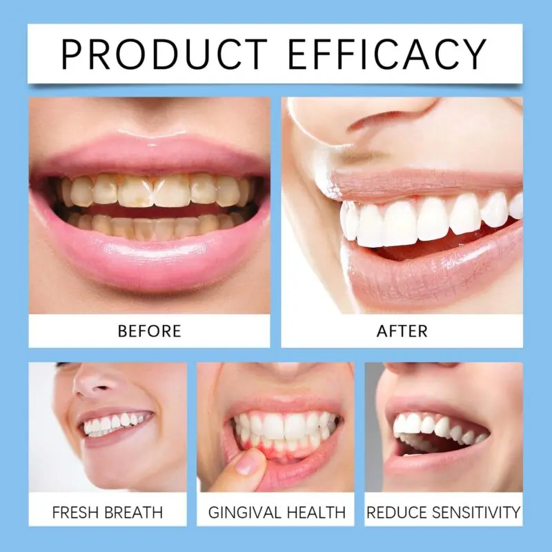 Oralhoe Coconut Mint Oil Mouthwash - Fresh Breath, Gum Care & Stain Removal - Image 4