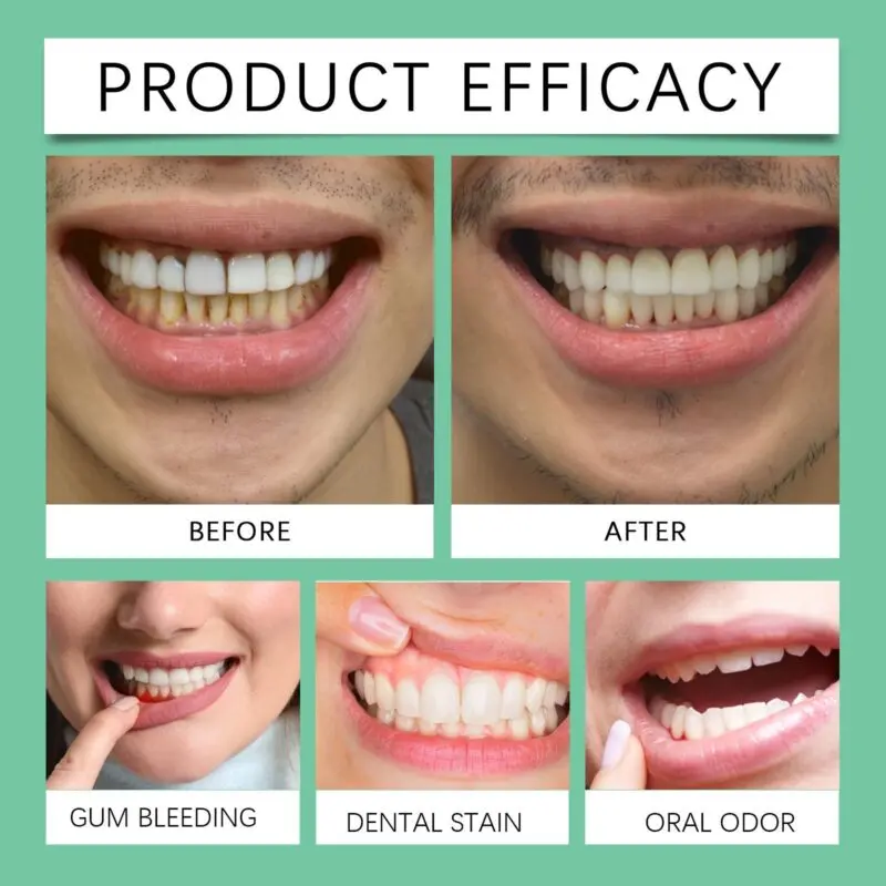 Oralhoe Oral Gums Mild Care Gel: Gentle Gum Care & Soothing Formula - Image 4