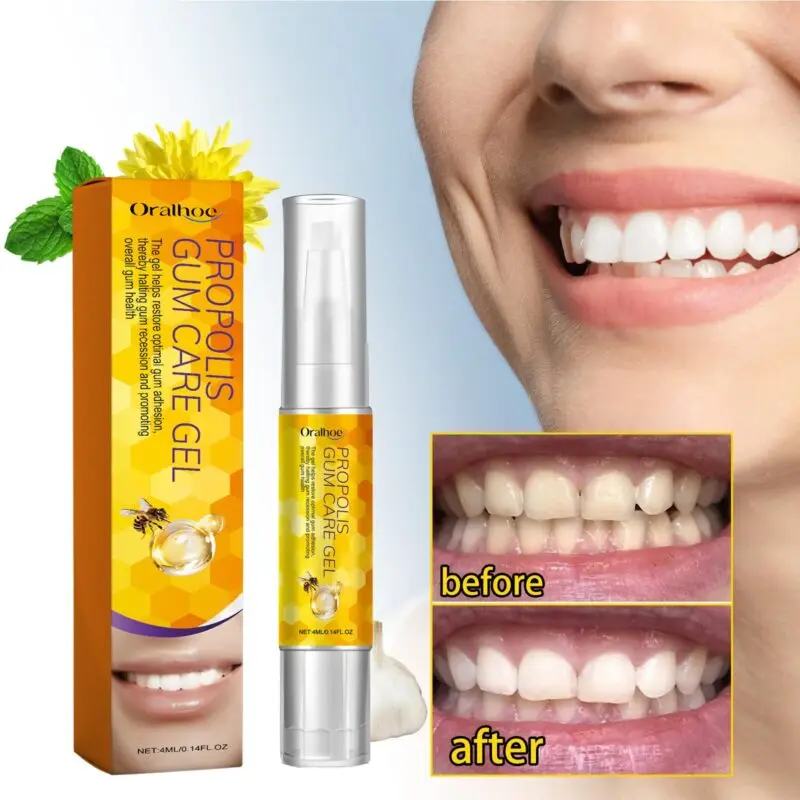 Oralhoe Propolis Gum Care Gel - Oral Care & Gum Health Gel - Image 2