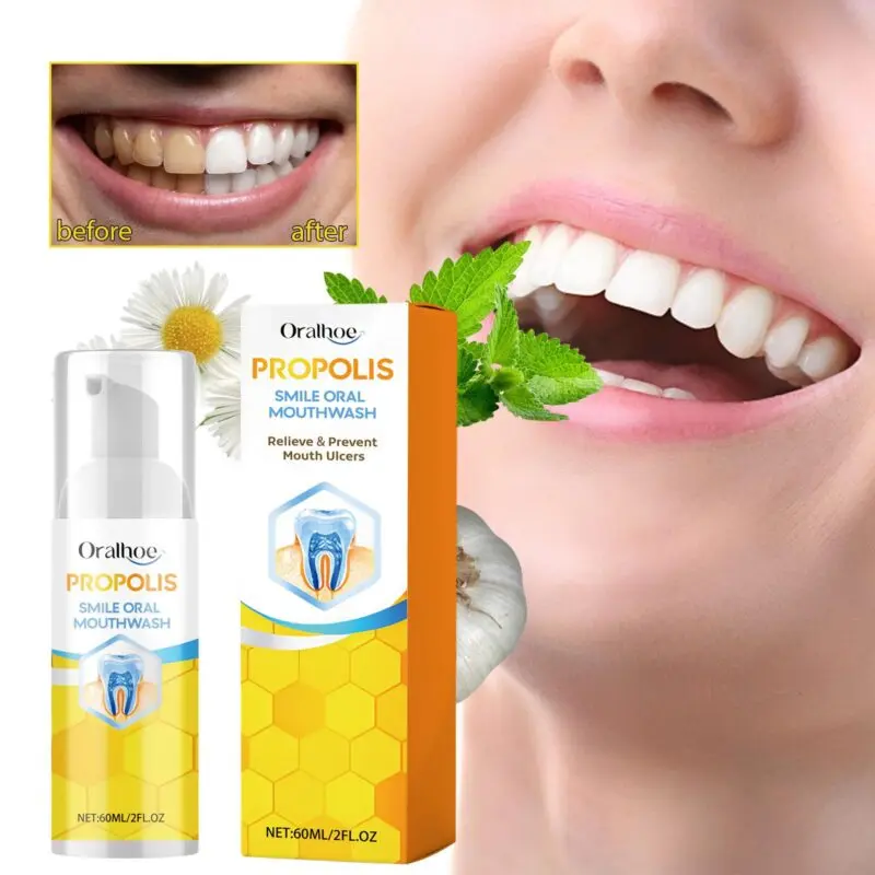 Oralhoe Propolis Oral Cleaning Mousse - Foaming Mouth Cleaner for Fresh Breath - Image 2