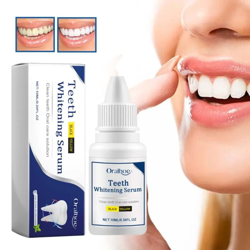 Oralhoe Teeth Whitening Serum: Stain Removal & Oral Care - Image 2