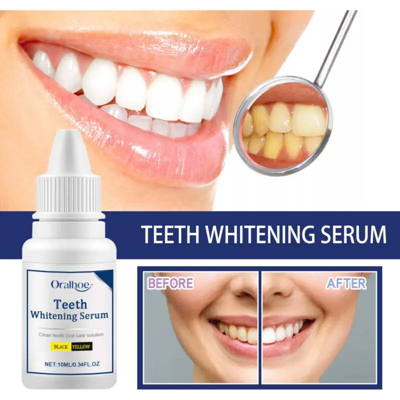 Oralhoe Teeth Whitening Serum: Stain Removal & Oral Care - Image 3