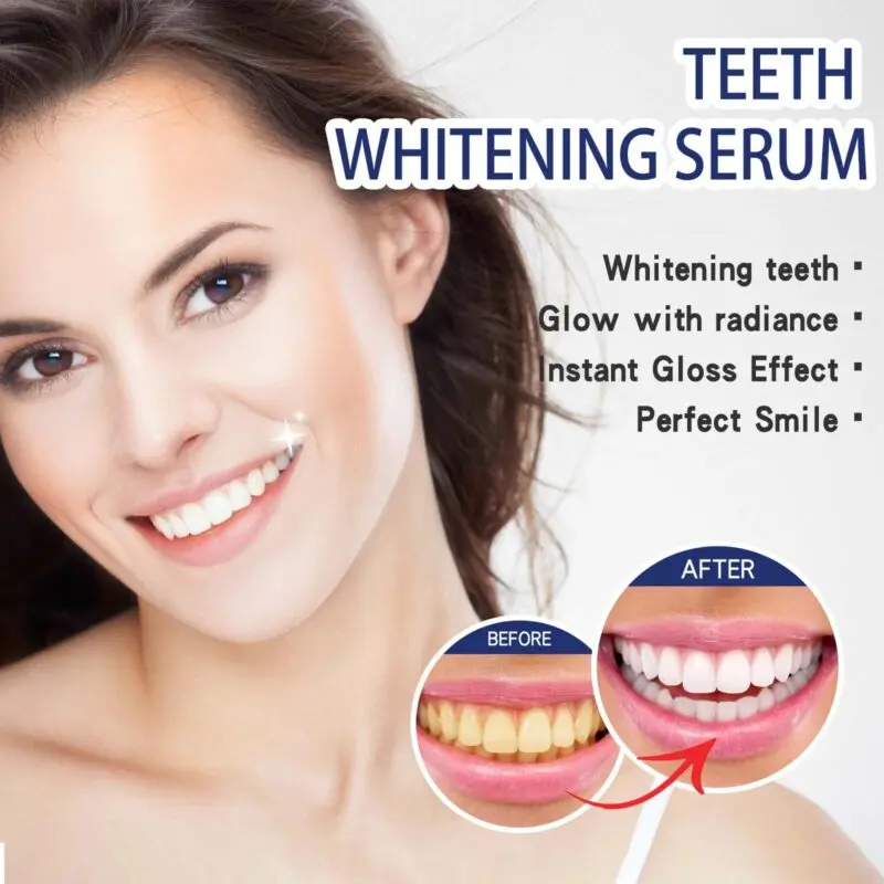 Oralhoe Teeth Whitening Serum: Stain Removal & Oral Care - Image 4