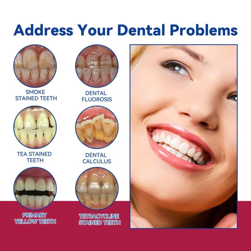 Oralhoe Toothpaste for Stain & Tartar Removal, Fresh Breath & Gum Care - Image 3