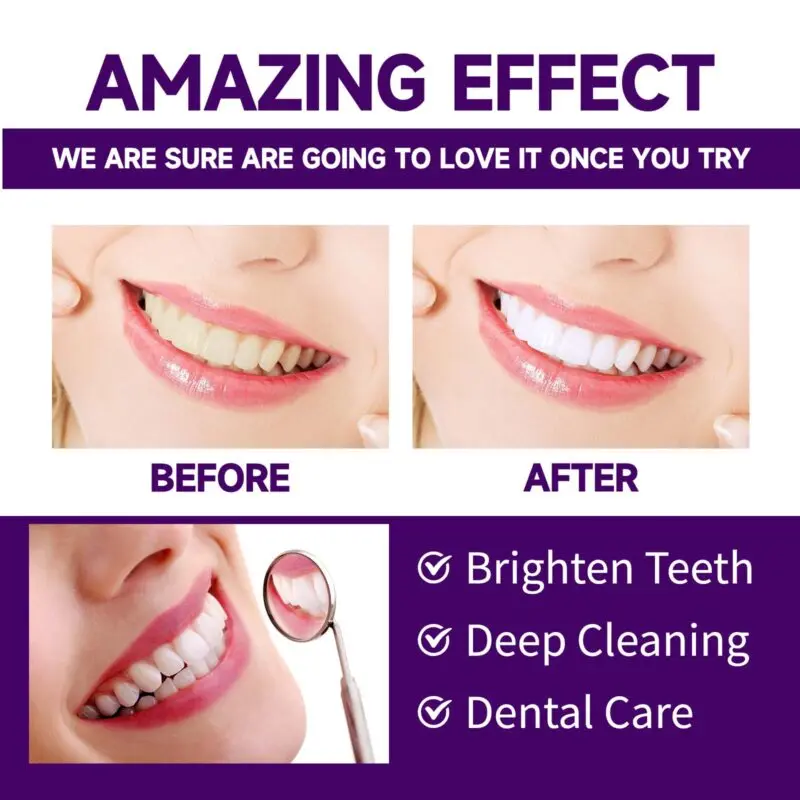Oralhoe Purple Tooth Powder for Teeth Whitening and Fresh Breath - Image 4