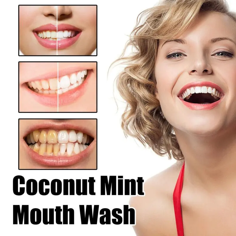 Oralhoe Coconut Mint Mouthwash - Deep Cleaning, Stain Removal & Fresh Breath - Image 3