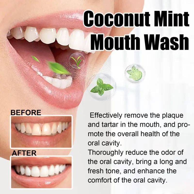 Oralhoe Coconut Mint Mouthwash - Deep Cleaning, Stain Removal & Fresh Breath - Image 4