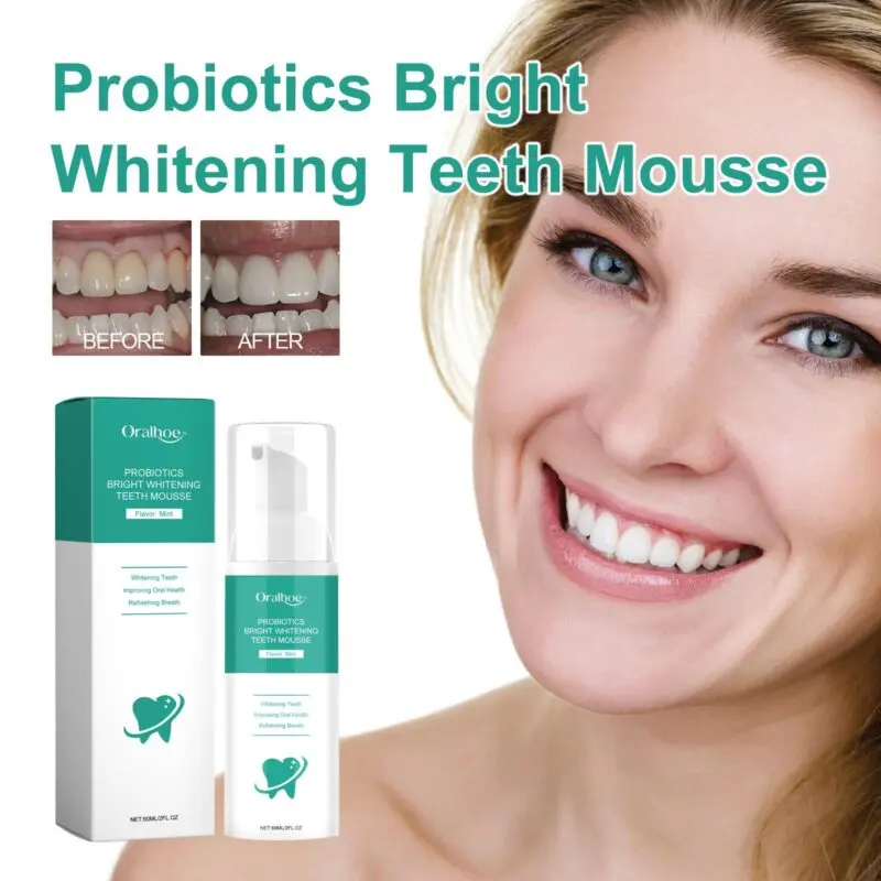 Oralhoe Probiotics Teeth Whitening Mousse - Tartar & Gum Care, Fresh Breath - Image 2