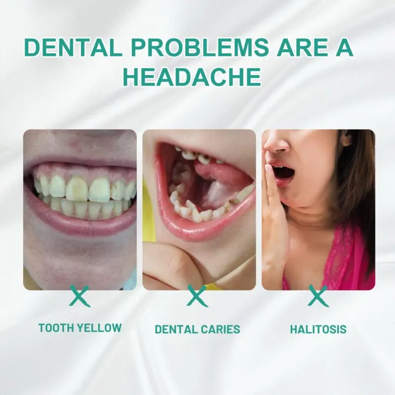 Oralhoe Probiotics Teeth Whitening Mousse - Tartar & Gum Care, Fresh Breath - Image 3