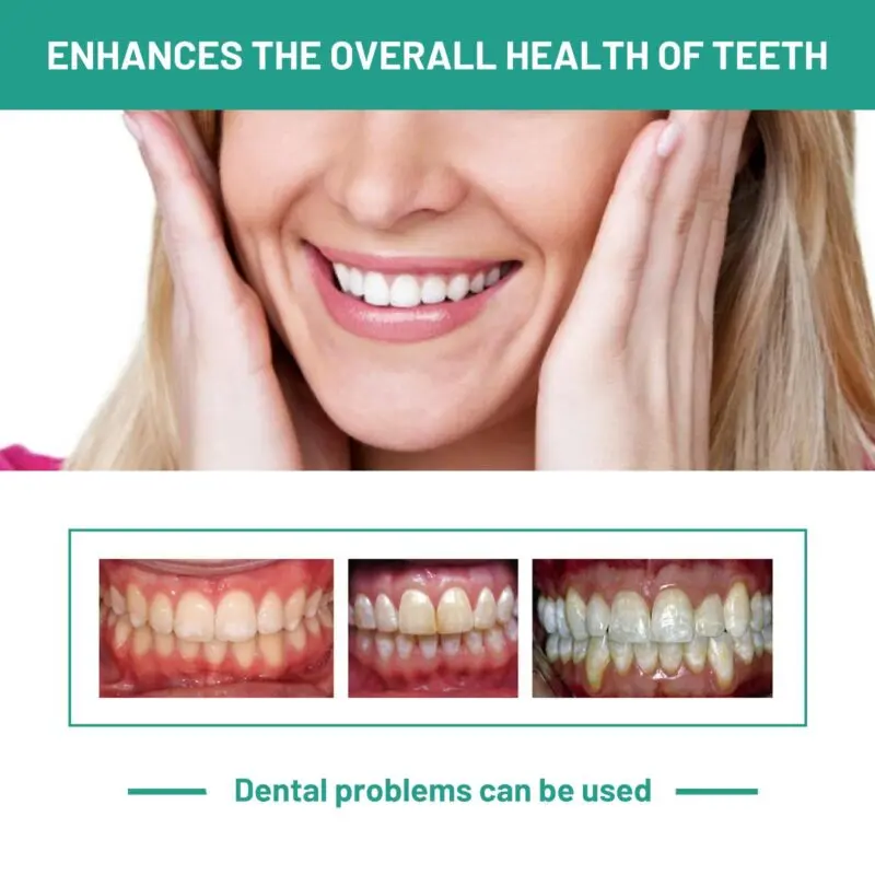 Oralhoe Probiotics Teeth Whitening Mousse - Tartar & Gum Care, Fresh Breath - Image 4