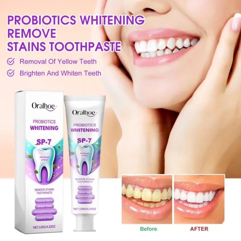 Oralhoe Probiotics Whitening Toothpaste for Stain Removal and Fresh Breath - Image 2