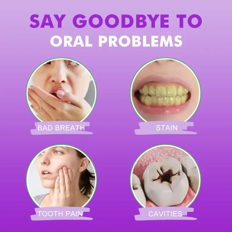 Oralhoe Probiotics Whitening Toothpaste for Stain Removal and Fresh Breath - Image 3