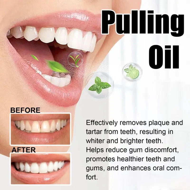 Oralhoe Puling Oil - Tartar Control, Fresh Breath & Teeth Protection - Image 4