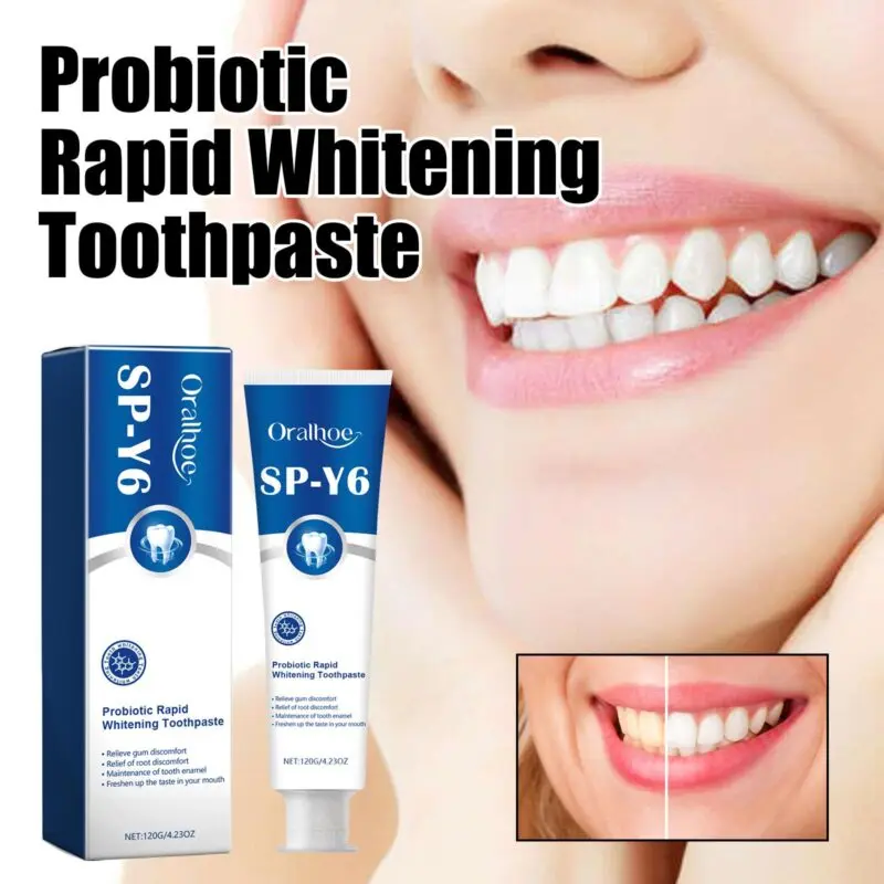 Oralhoe Probiotic Whitening Toothpaste for Fresh Breath, Stain & Tartar - Image 2