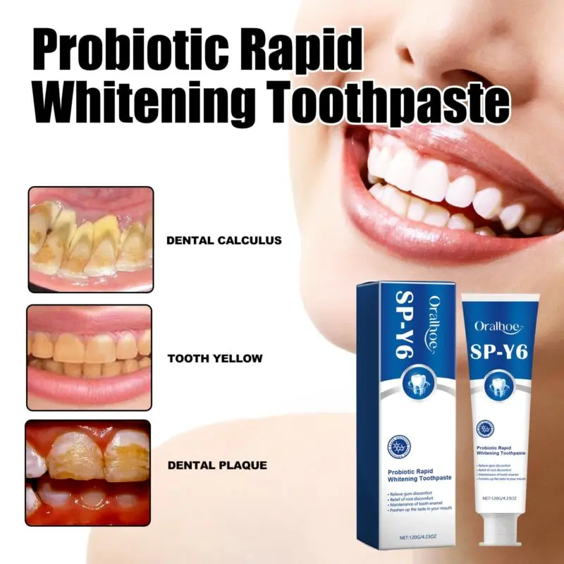 Oralhoe Probiotic Whitening Toothpaste for Fresh Breath, Stain & Tartar - Image 3