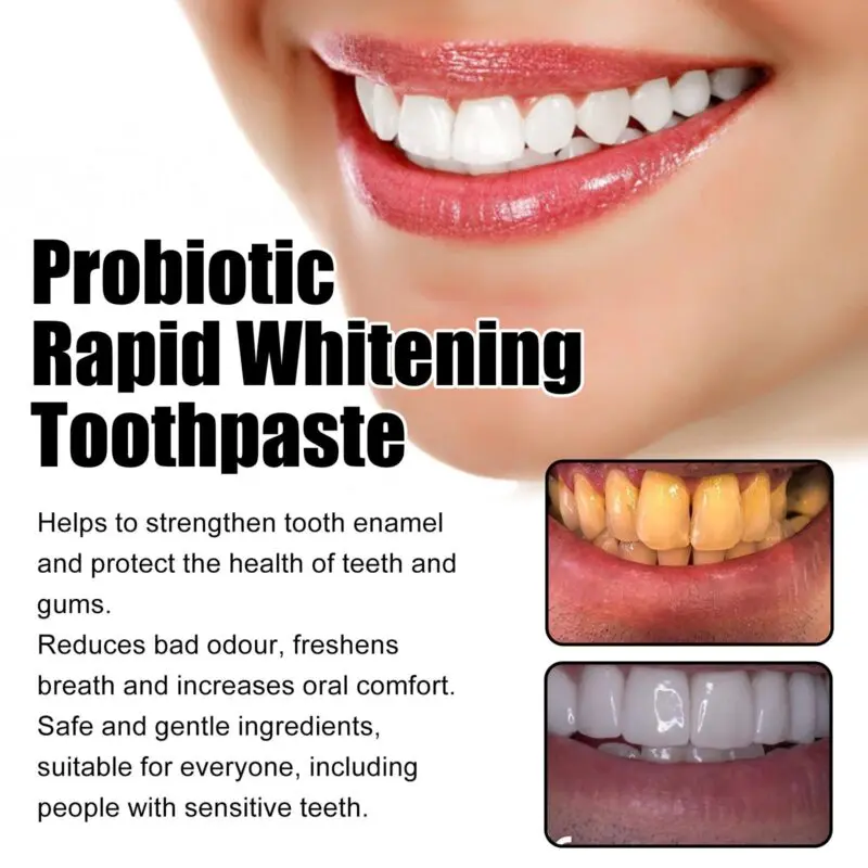 Oralhoe Probiotic Whitening Toothpaste for Fresh Breath, Stain & Tartar - Image 4