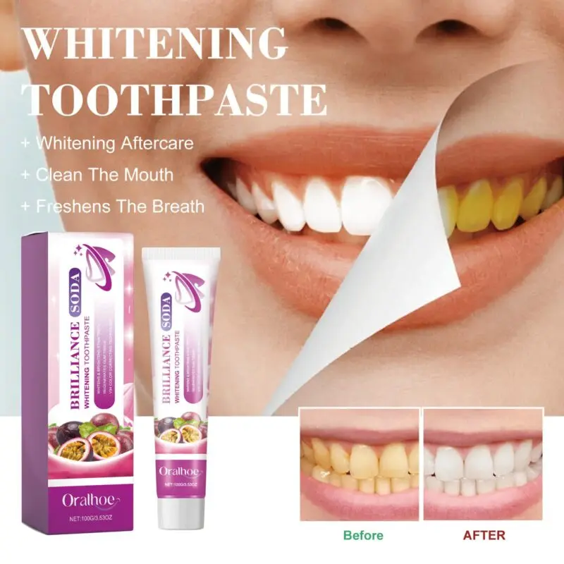 Oralhoe Whitening Toothpaste: Gum Care, Stain & Tartar Control, Fresh Breath - Image 2