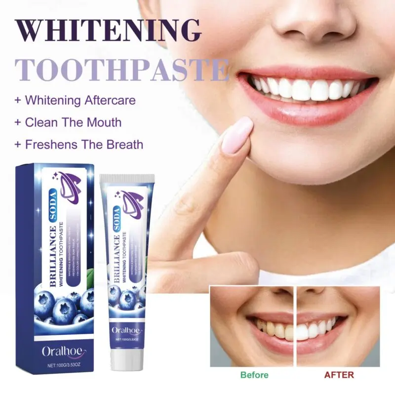 Oralhoe Whitening Toothpaste - Gum Care, Tartar & Stain Removal, Fresh Breath - Image 2