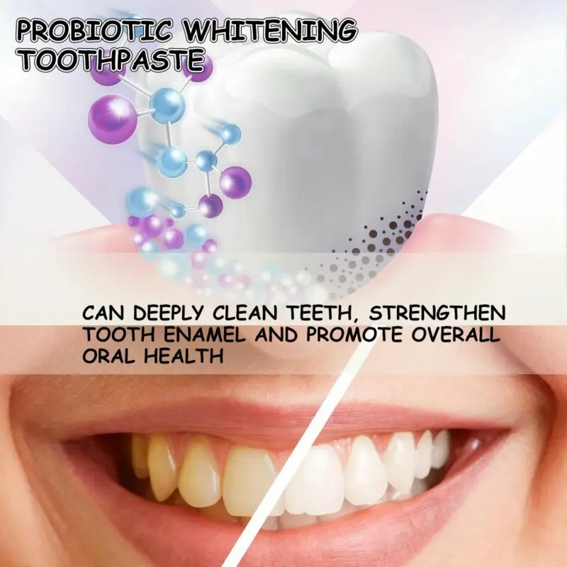 Oralhoe Probiotic Toothpaste for Whitening, Stain Removal & Gum Care - Image 3