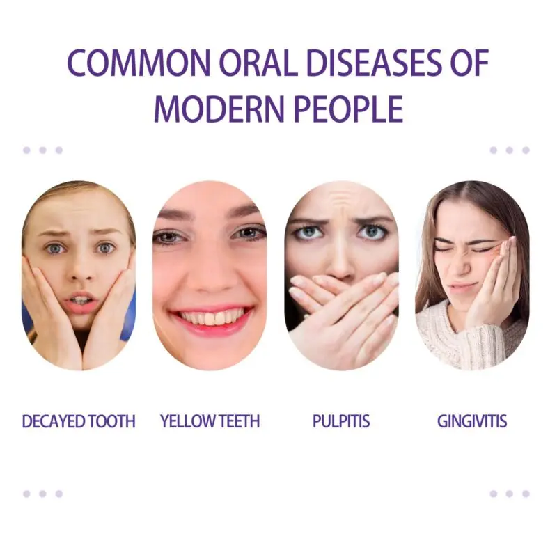 Oralhoe Purple Whitening Toothpaste - Tartar Removal & Teeth Whitening - Image 3