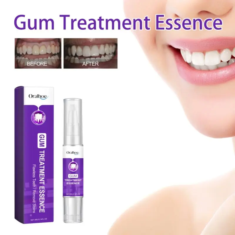 Oralhoe Gum Treatment Essence: Oral Cleaning, Teeth Whitening & Gum Care Dental Pen - Image 2