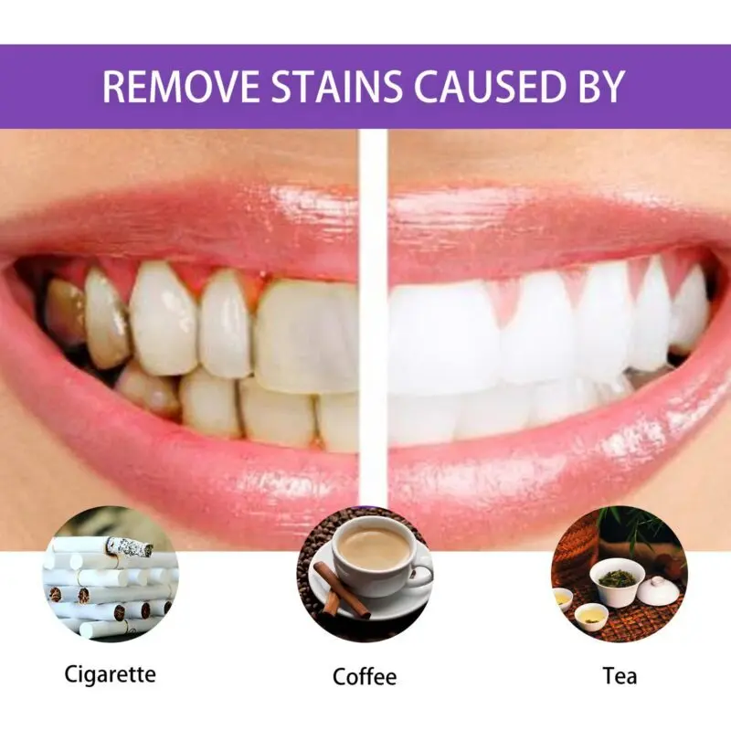 Oralhoe Gum Treatment Essence: Oral Cleaning, Teeth Whitening & Gum Care Dental Pen - Image 3