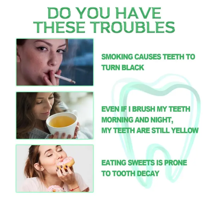 Oralhoe Teeth Whitening Serum for Yellow Stain Removal and Gum Care - Image 5