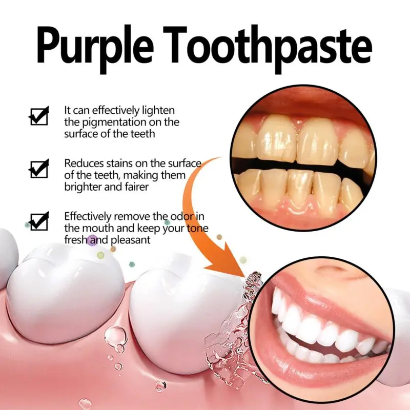 Oralhoe Purple Toothpaste - Tartar & Stain Removal, Fresh Breath - Image 3