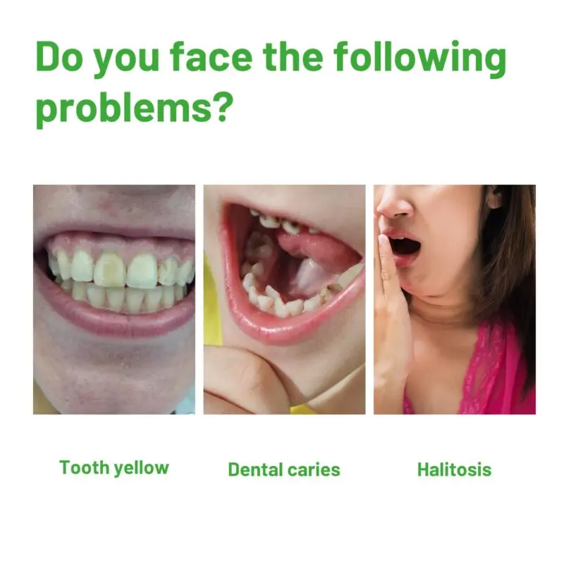 Oralhoe Herbal Oral Foam: Tartar Cleaning, Fresh Breath & Teeth Whitening - Image 3