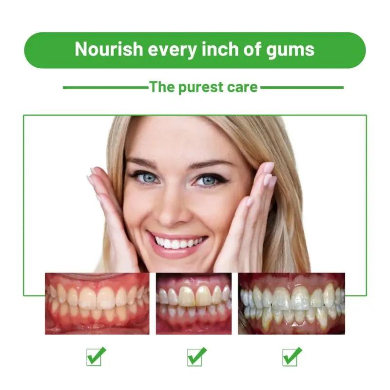 Oralhoe Herbal Oral Foam: Tartar Cleaning, Fresh Breath & Teeth Whitening - Image 4