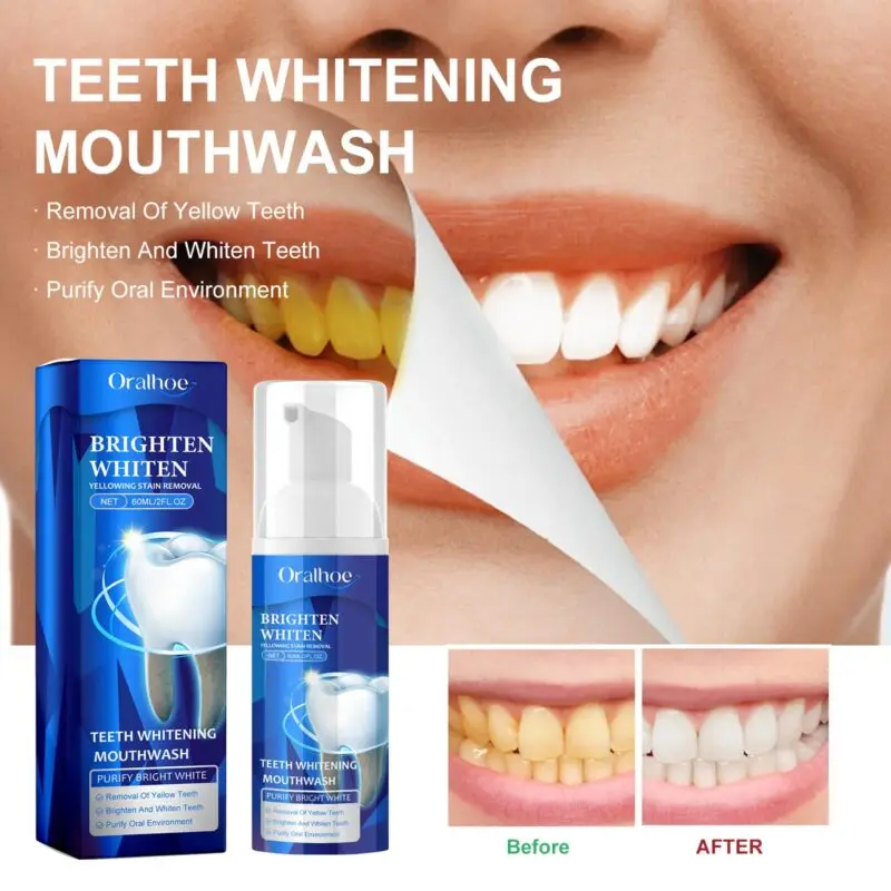 Oralhoe Teeth Whitening Mouthwash - Stain Prevention, Fresh Breath Oral Rinse - Image 2