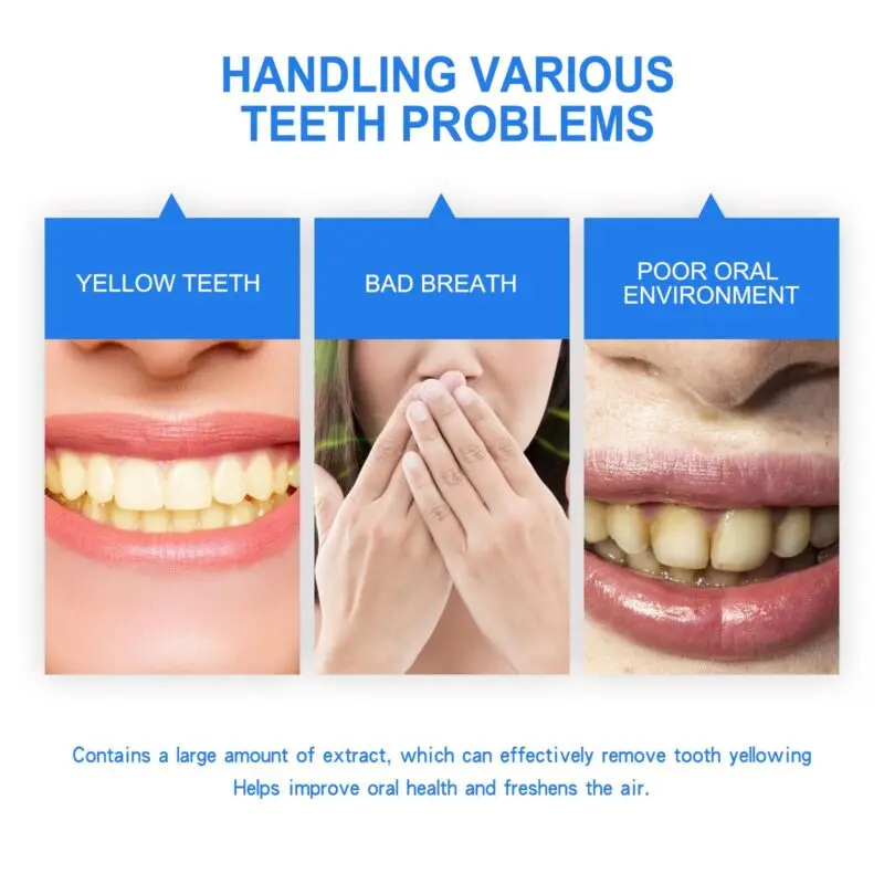 Oralhoe Teeth Whitening Mouthwash - Stain Prevention, Fresh Breath Oral Rinse - Image 3