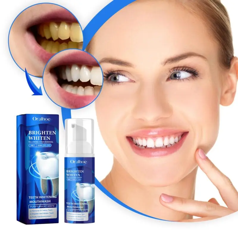 Oralhoe Teeth Whitening Mouthwash - Stain Prevention, Fresh Breath Oral Rinse - Image 4