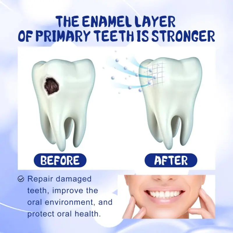 Oralhoe Anti-Cavity Toothpaste for Gum Care and Fresh Breath - Image 3