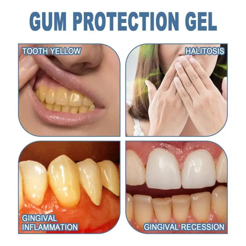 Oralhoe Gum Protection Gel with Dental Applicator for Oral Care - Image 3