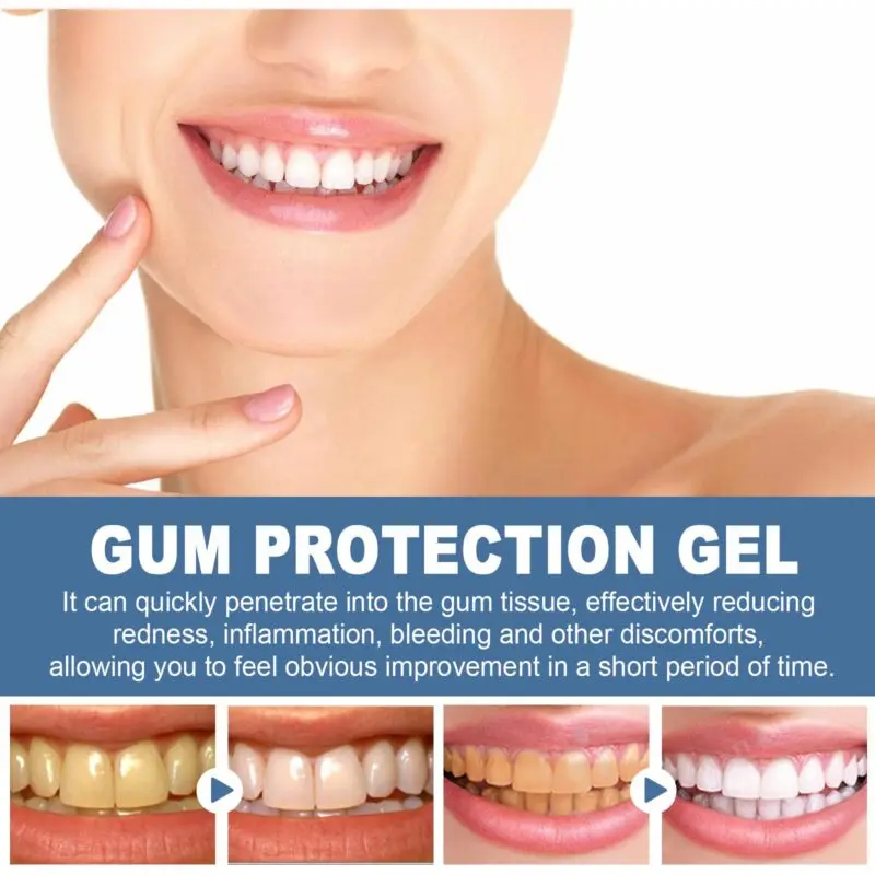 Oralhoe Gum Protection Gel with Dental Applicator for Oral Care - Image 4