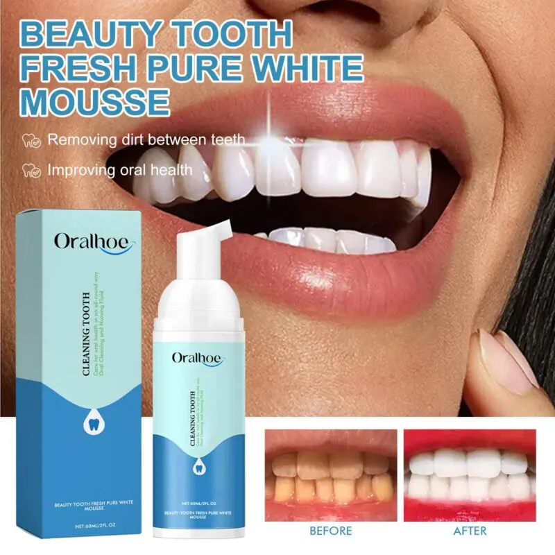Oralhoe Beauty Tooth Mousse: Foaming Toothpaste for Bad Breath, Stain Removal, Gum Care & Whitening - Image 2