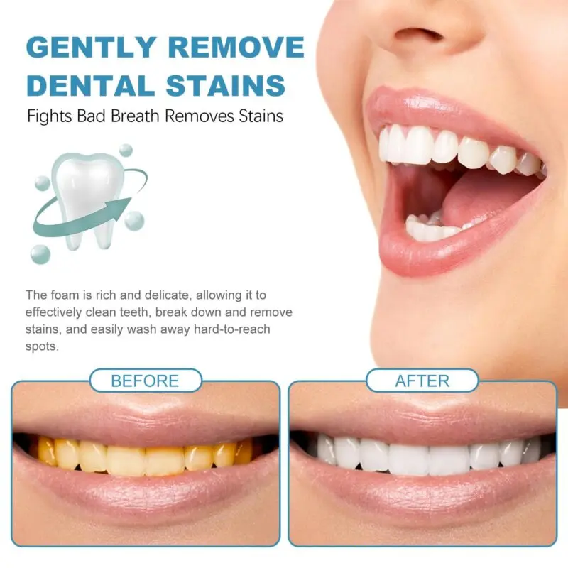 Oralhoe Beauty Tooth Mousse: Foaming Toothpaste for Bad Breath, Stain Removal, Gum Care & Whitening - Image 3