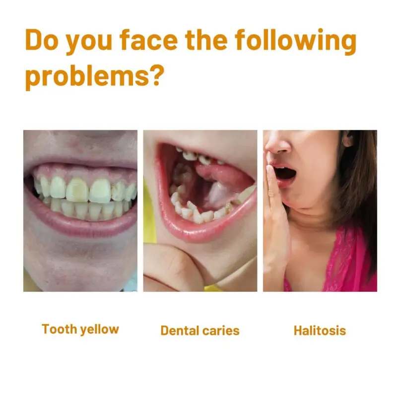 Oralhoe Teeth Whitening Mousse - Cleaning, Gum Care & Fresh Breath - Image 3